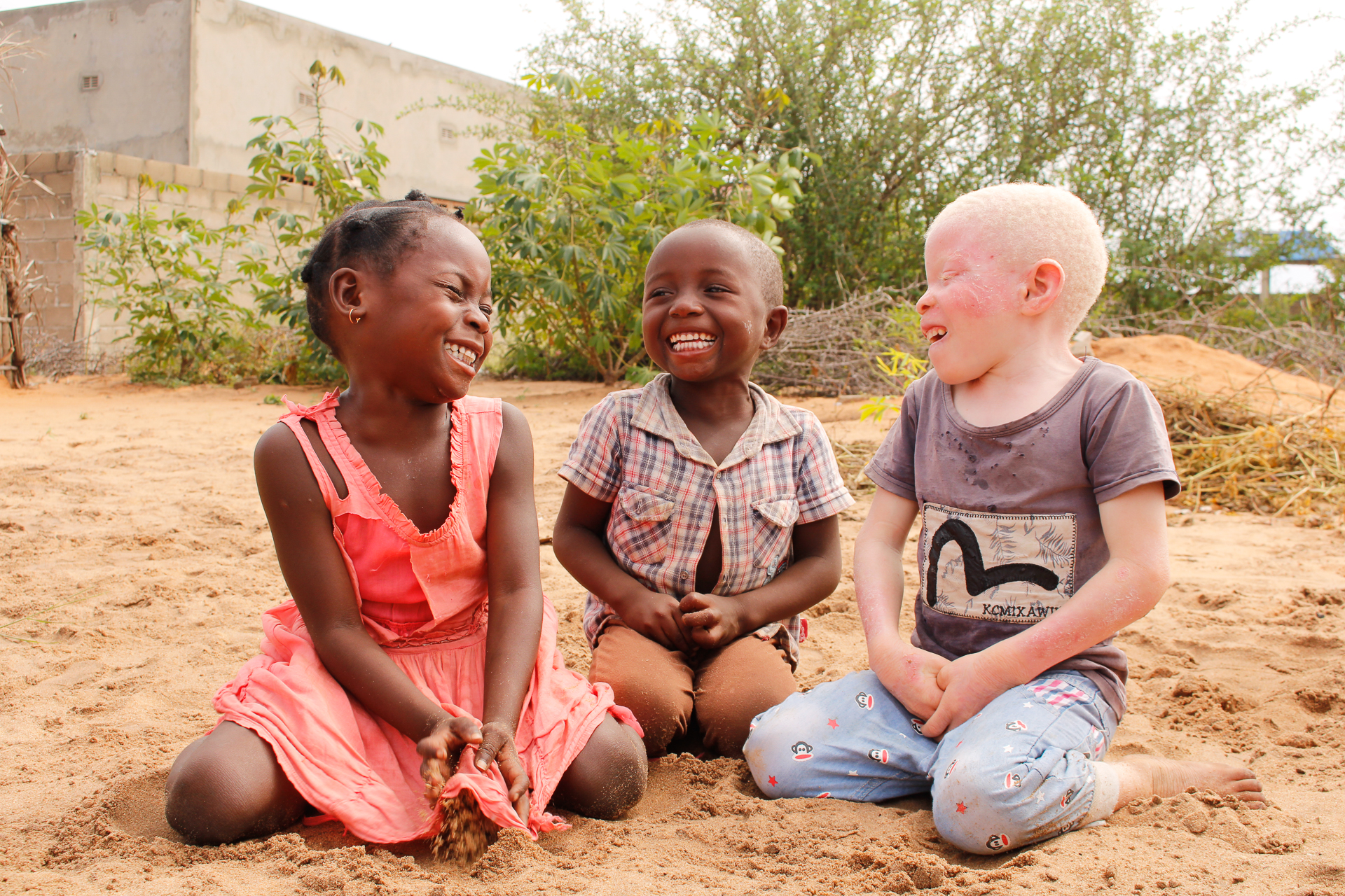 UN International Albinism Awareness Day: Shedding Light on Challenges Facing Persons with Albinism